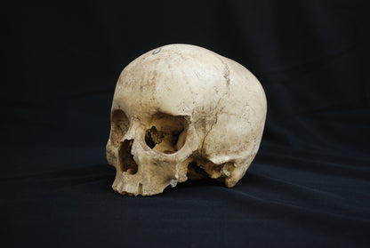 Human skull for educational purposes