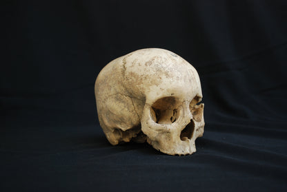 Human skull for educational purposes