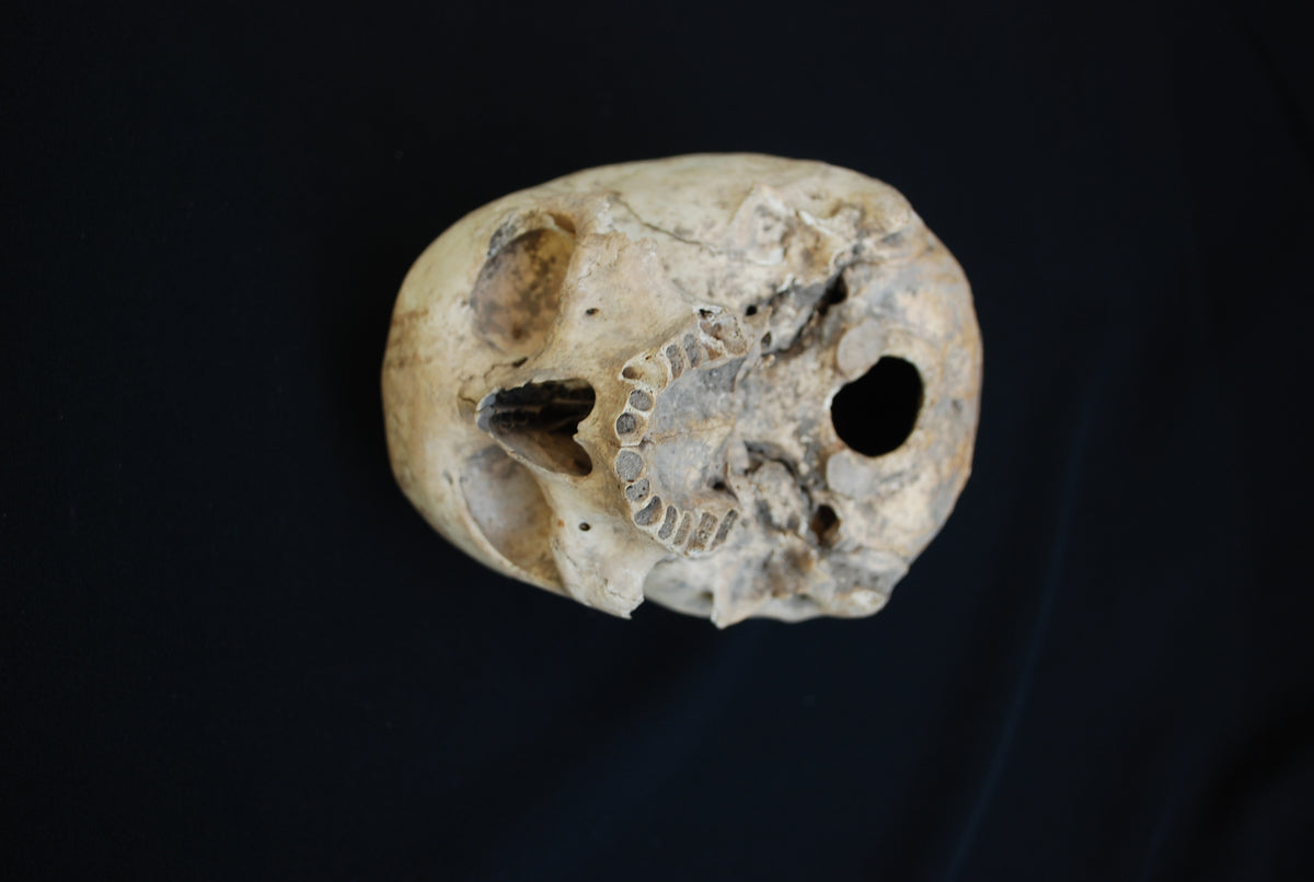 Human skull for educational purposes